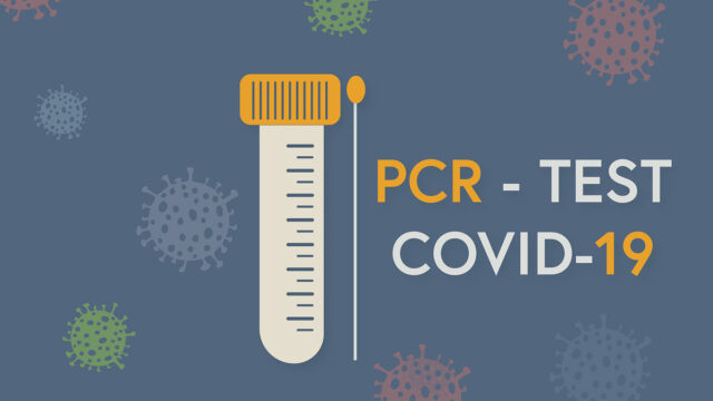 Knapp­heit: Das Ringen um PCR-Tests